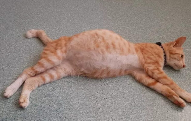 Bụng phình to có thể do ung thư